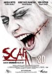 Scar 3D